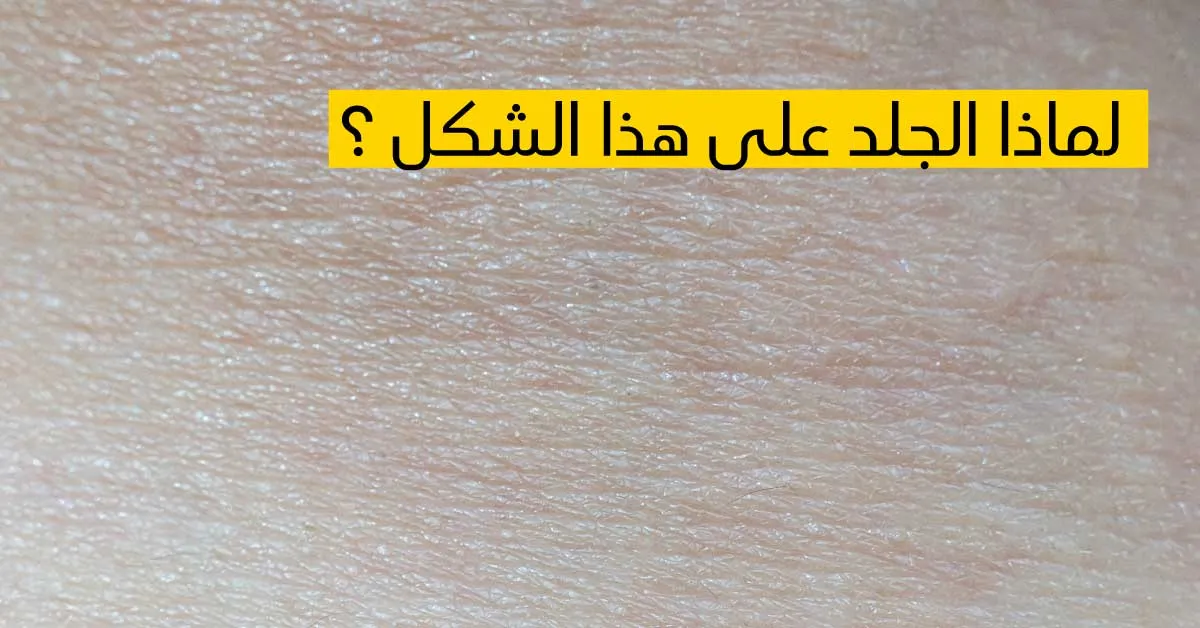    لماذا الجلد على هذا الشكل ؟